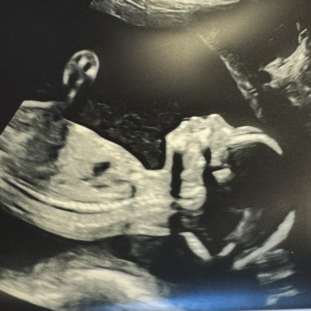 Photo shared by Sonya for their Babylist baby registry.