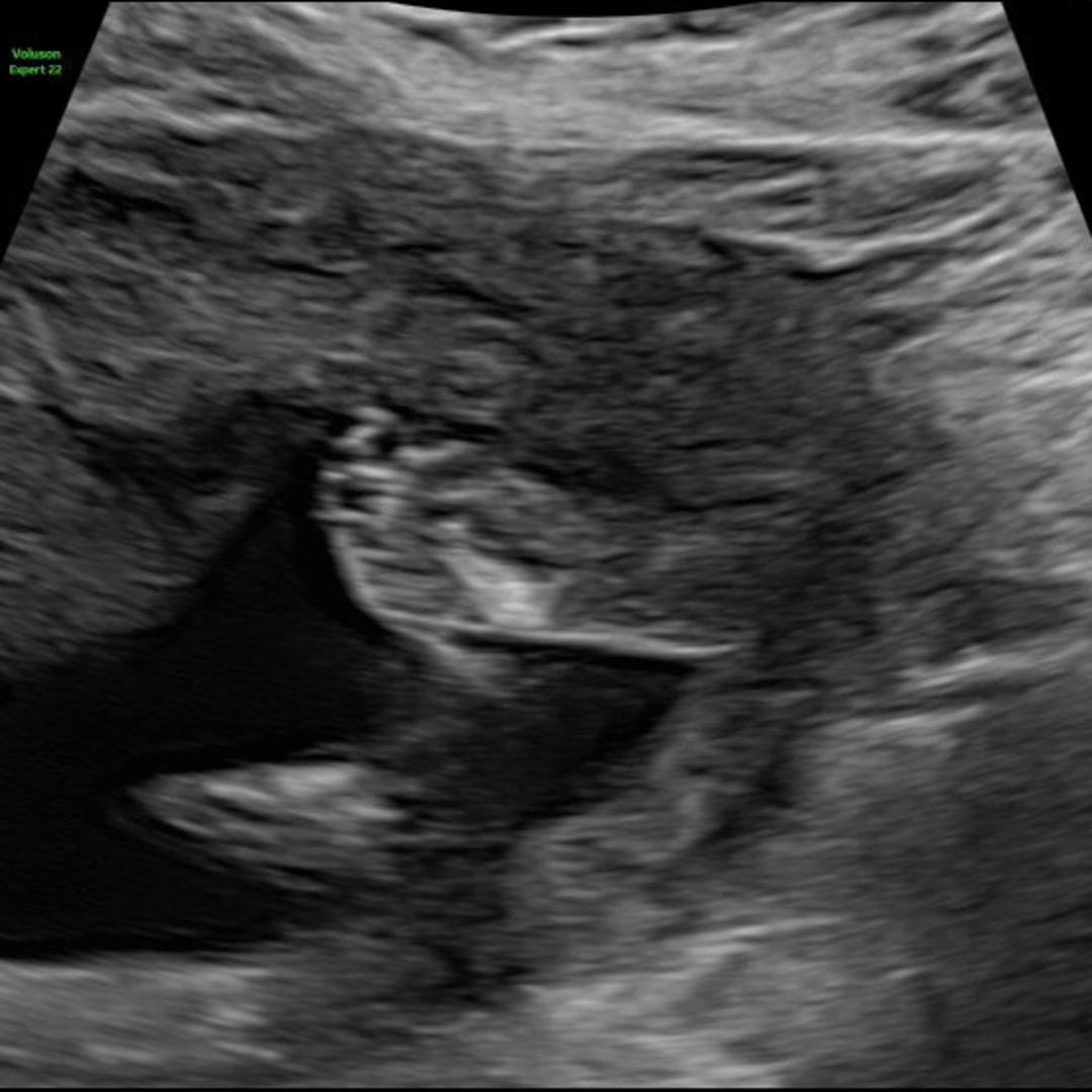 Photo shared by Beka for their Babylist baby registry.