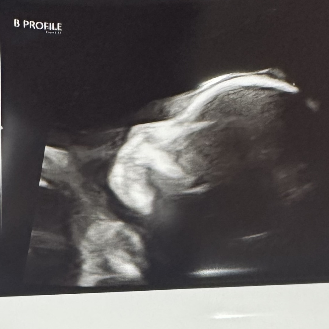 Photo shared by Alyssa for their Babylist baby registry.