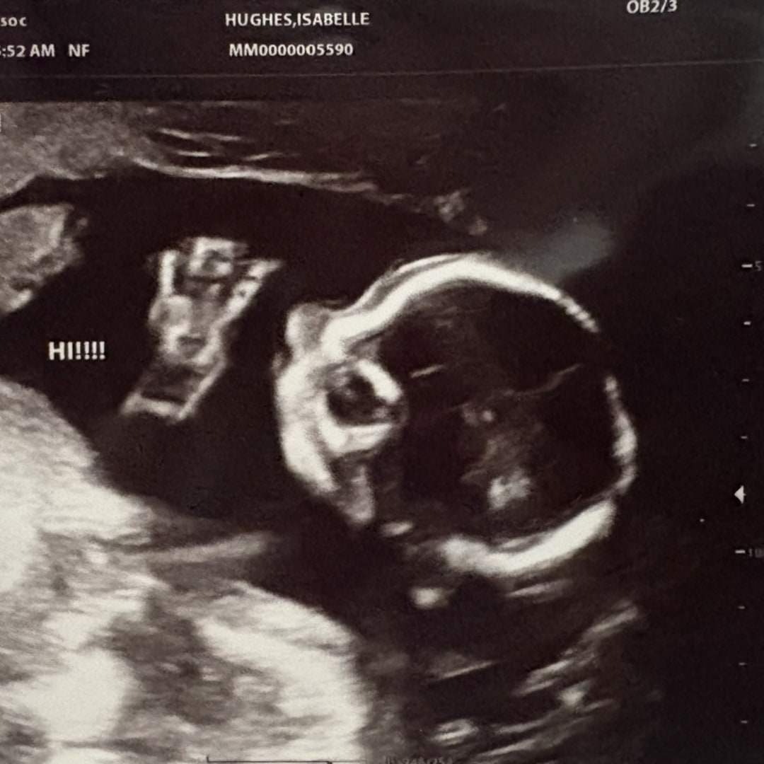 Photo shared by Isabelle for their Babylist baby registry.