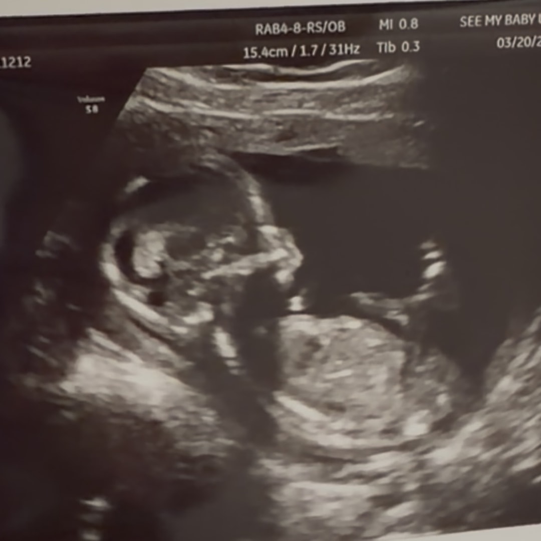 Photo shared by Duvrashka for their Babylist baby registry.