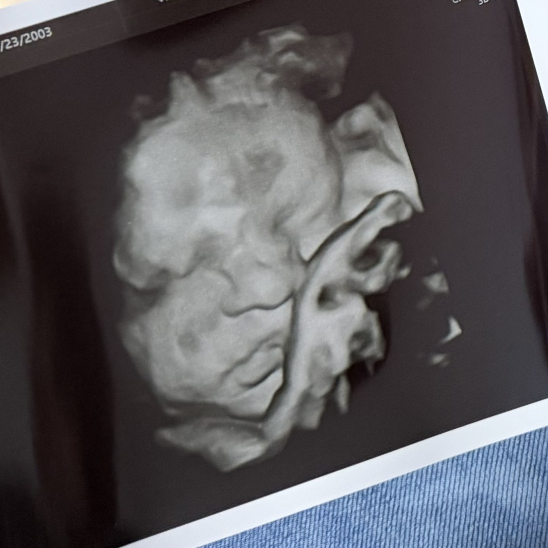 Photo shared by Patricia for their Babylist baby registry.
