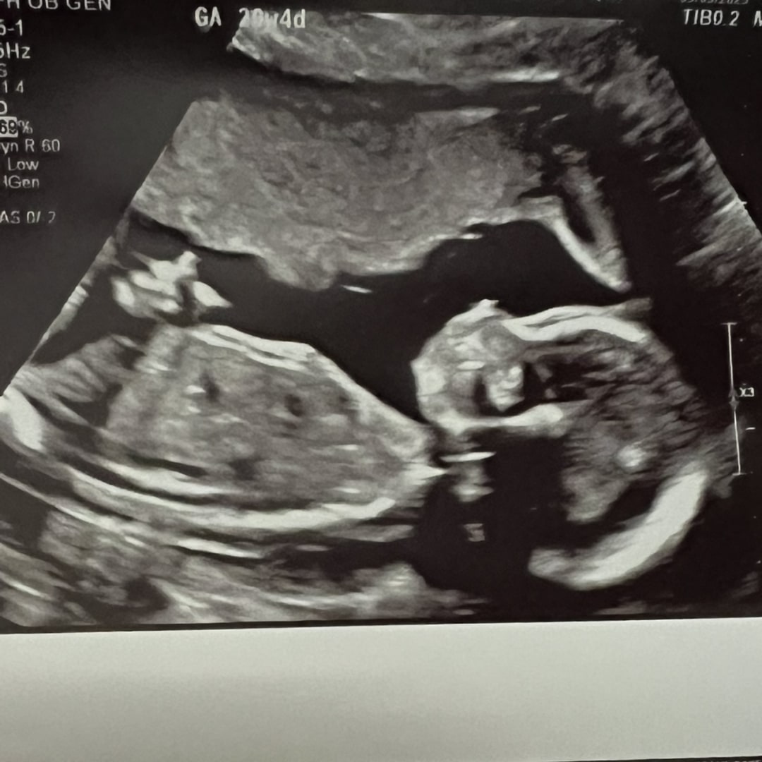 Photo shared by Kileigh for their Babylist baby registry.