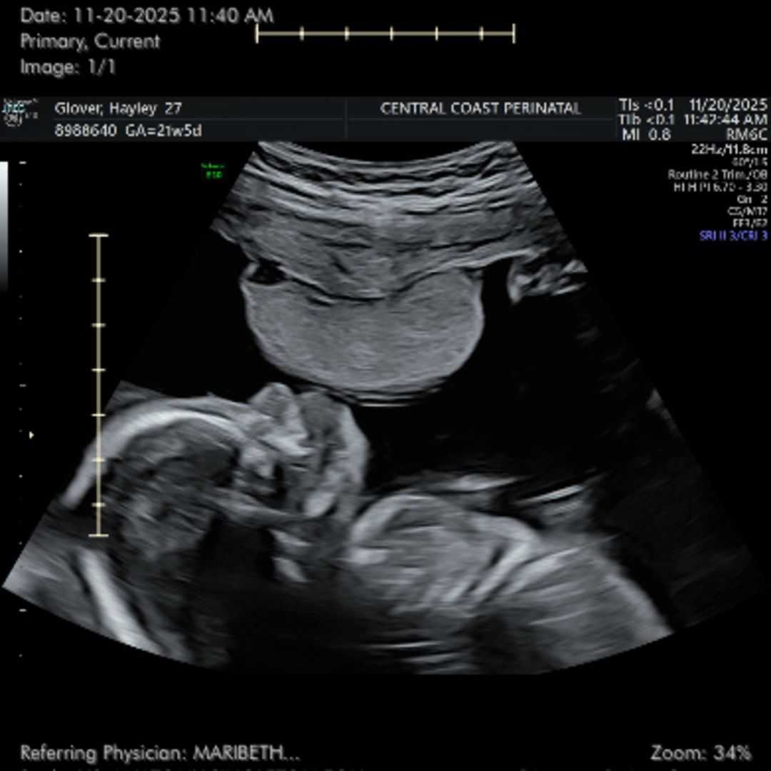 Photo shared by Hayley for their Babylist baby registry.