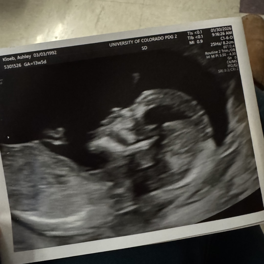 Photo shared by Ashley for their Babylist baby registry.