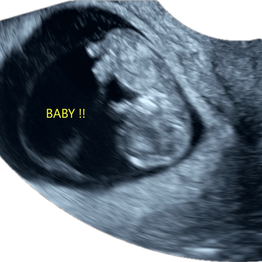 Photo shared by Angel for their Babylist baby registry.