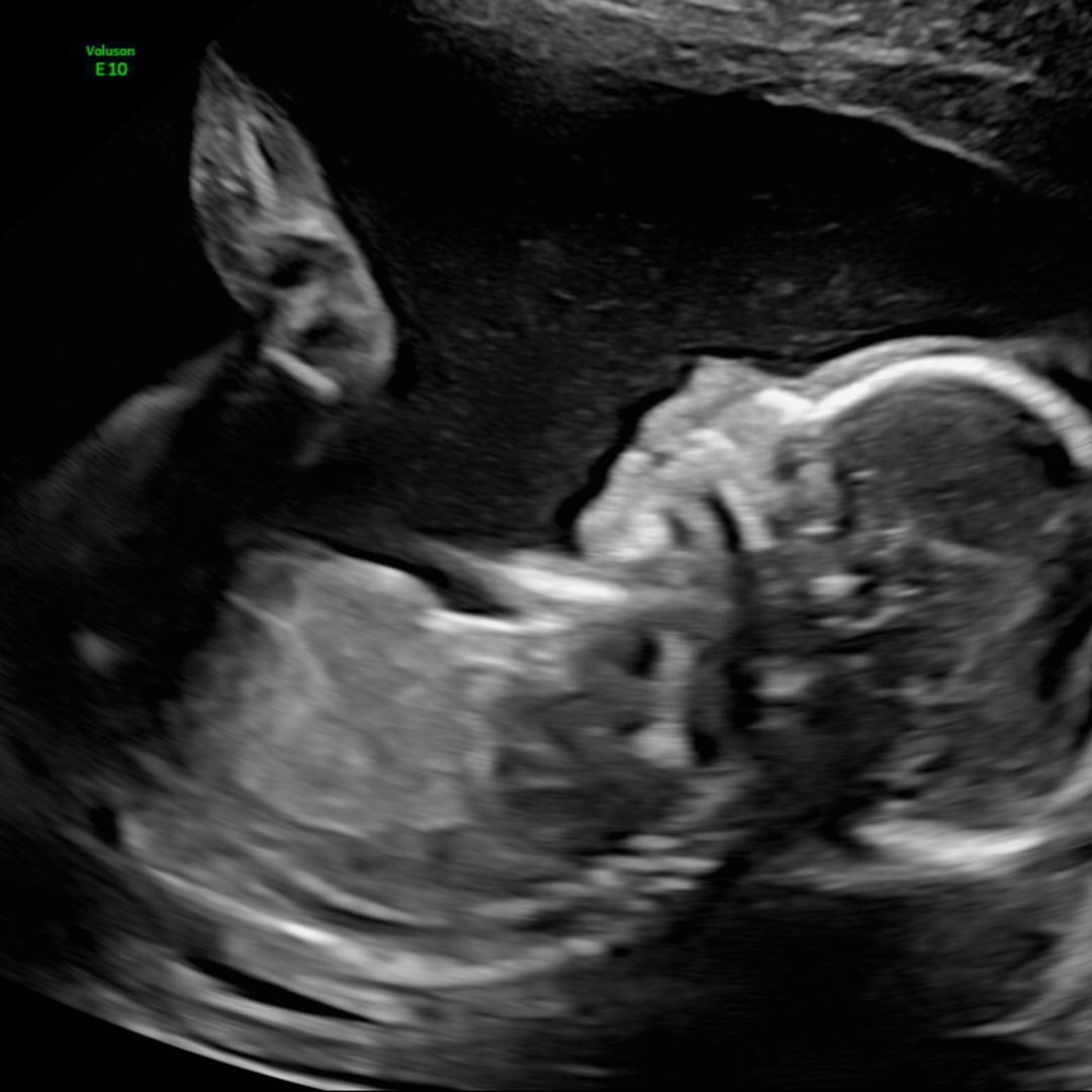 Photo shared by Sara for their Babylist baby registry.