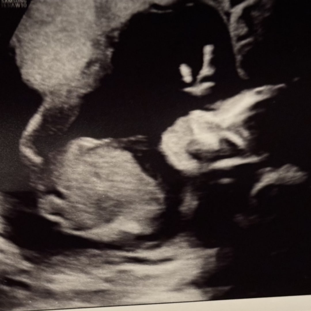 Photo shared by Beatrice for their Babylist baby registry.