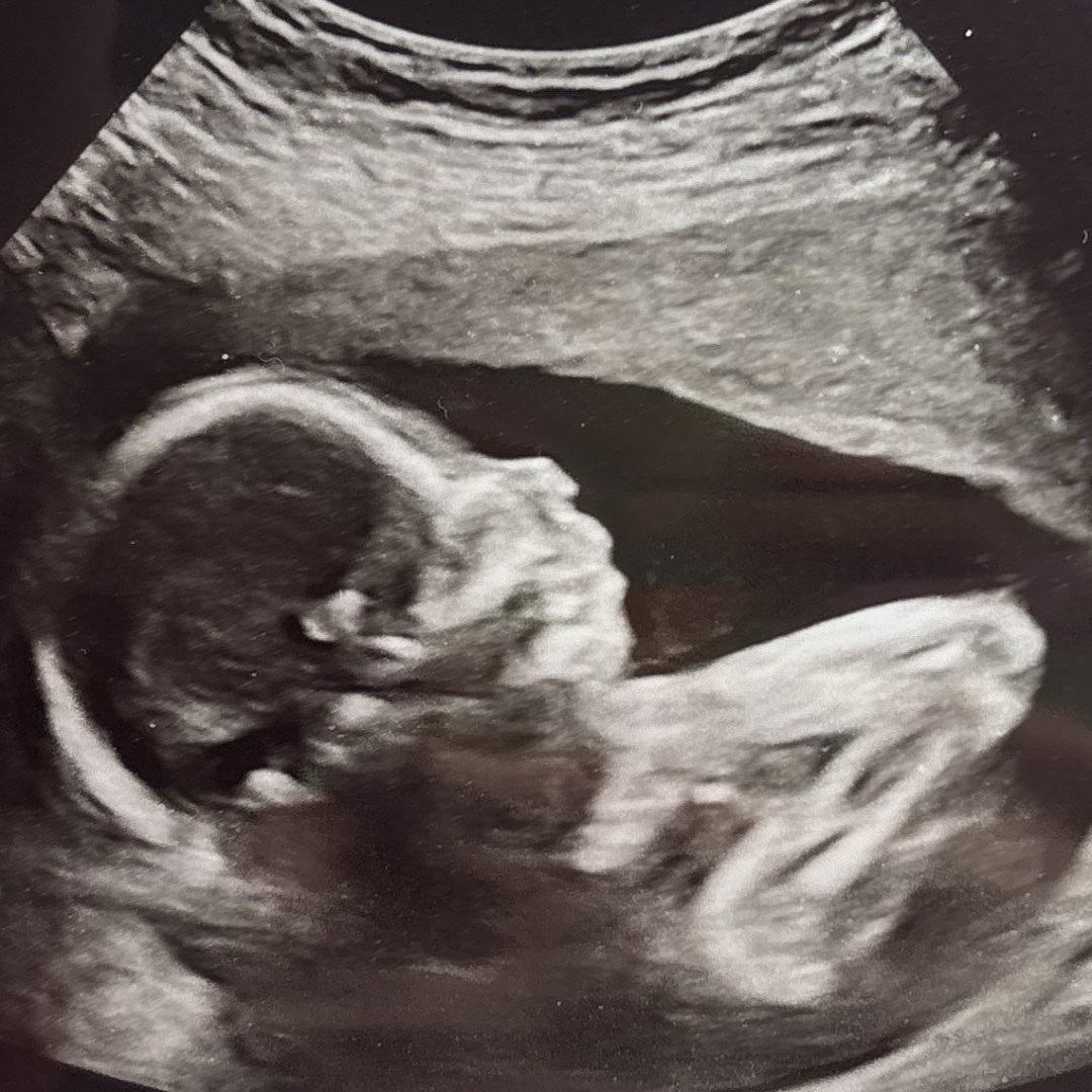 Photo shared by Zan for their Babylist baby registry.