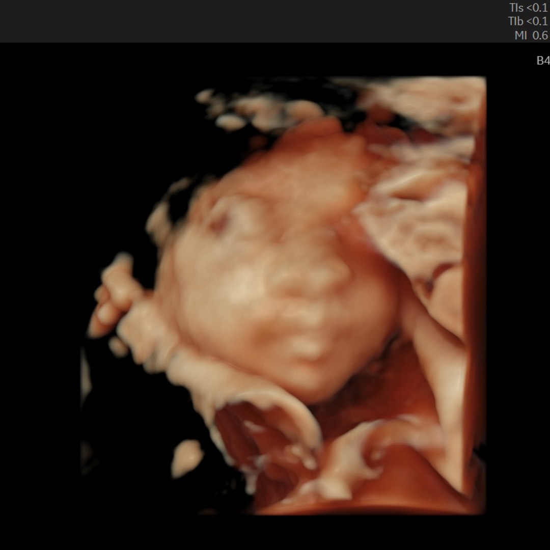 Photo shared by Kelcie for their Babylist baby registry.