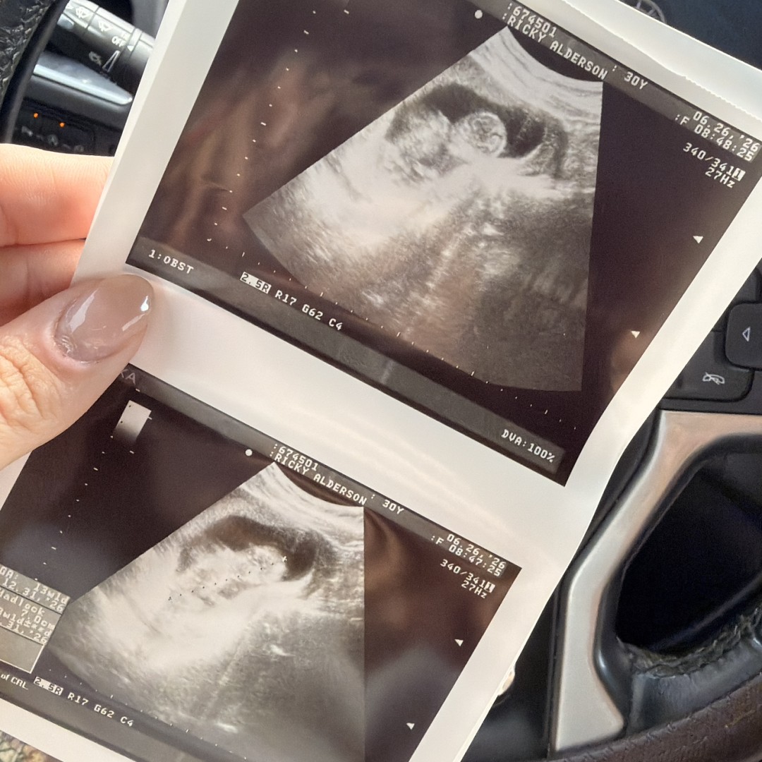 Photo shared by Ricky for their Babylist baby registry.