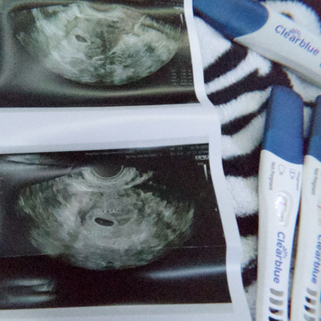 Photo shared by Kyleigh for their Babylist baby registry.