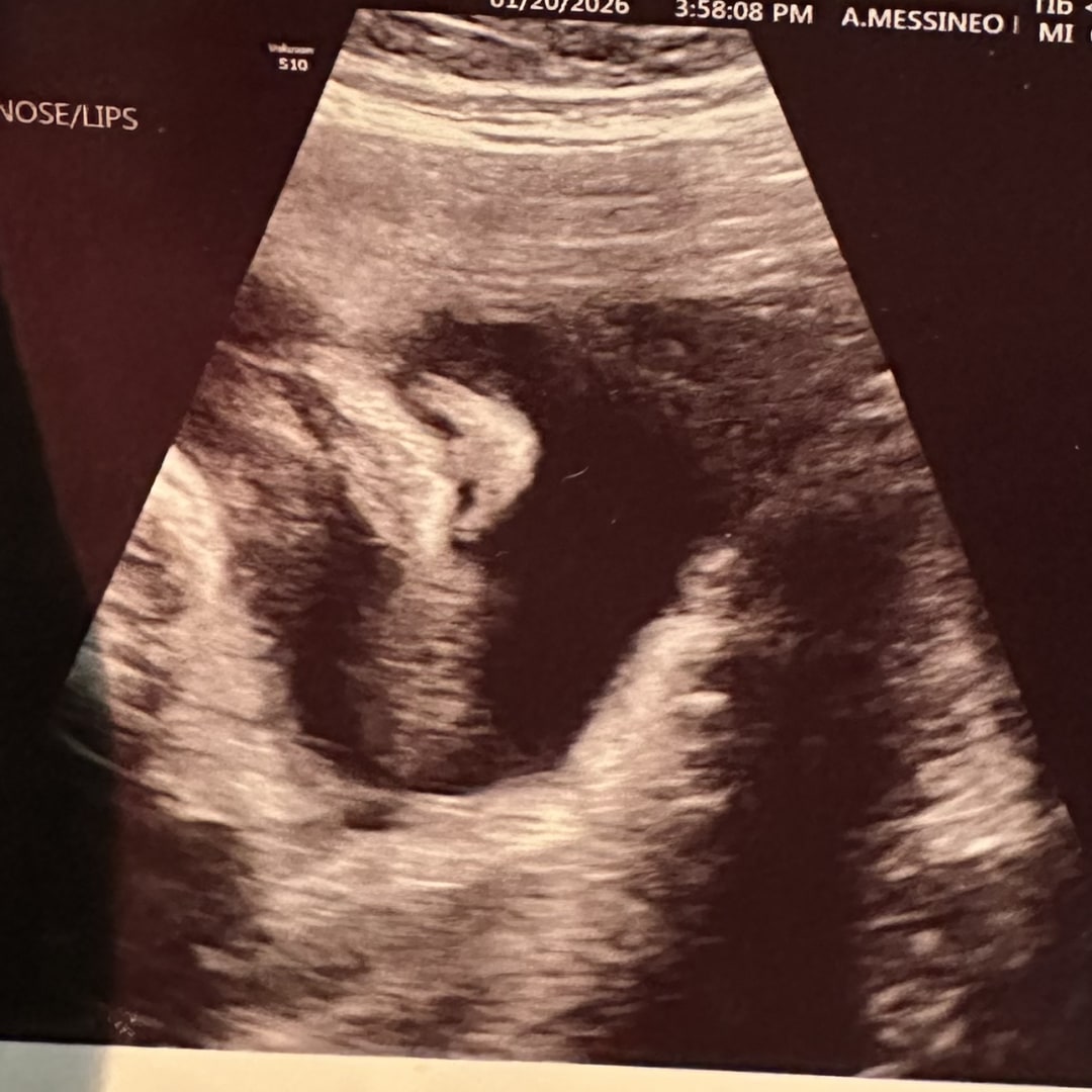 Photo shared by Amanda for their Babylist baby registry.