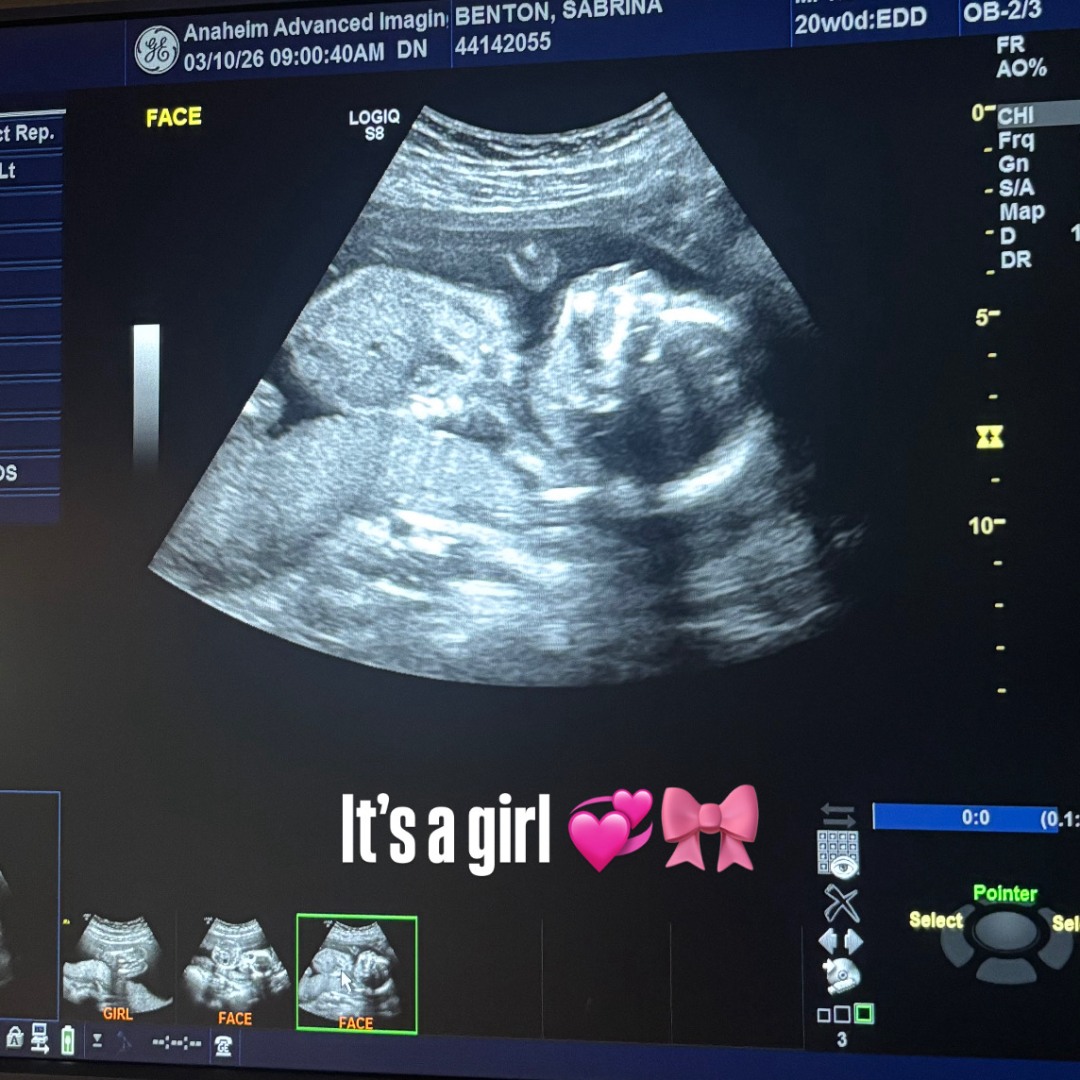 Photo shared by Sabrina for their Babylist baby registry.