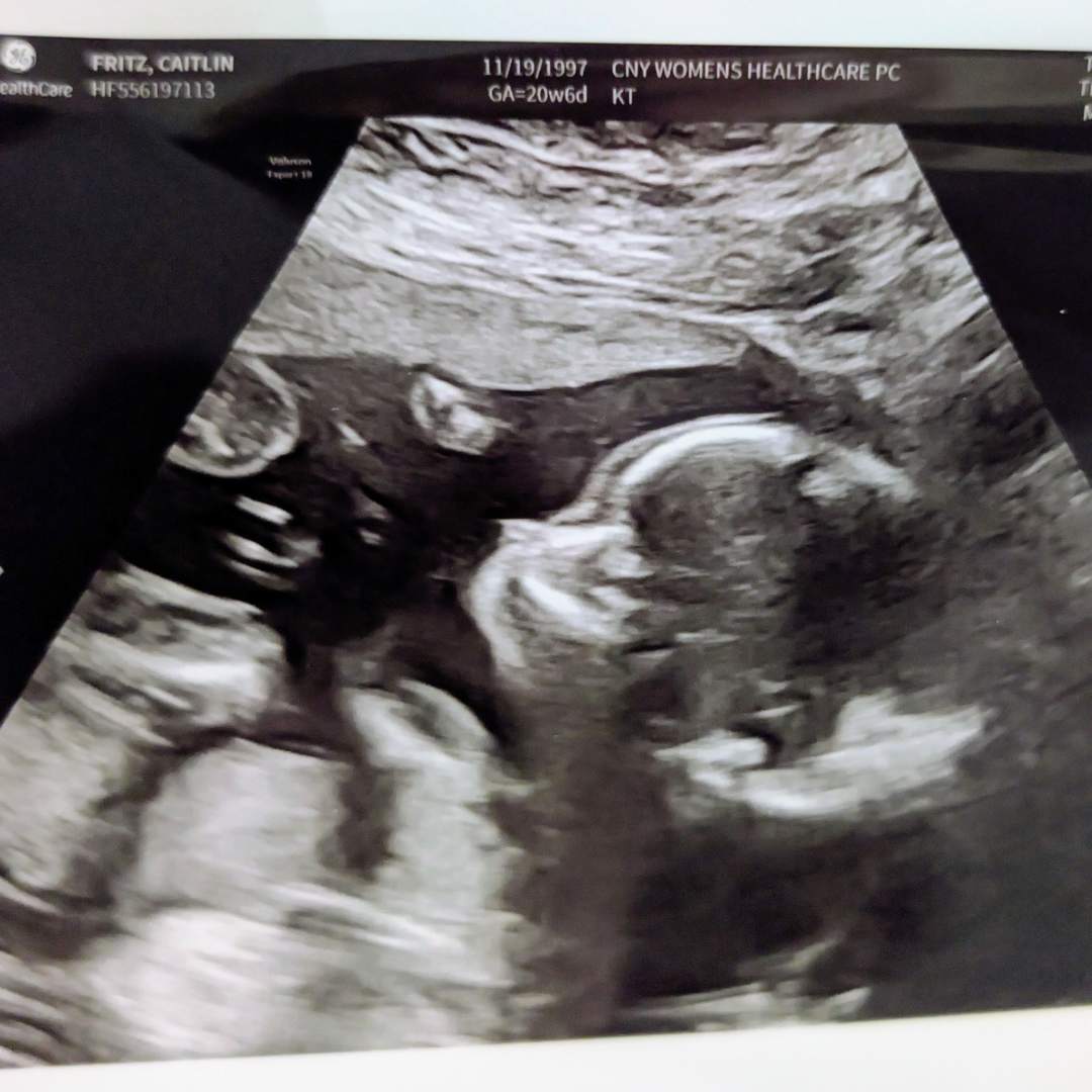 Photo shared by Caitlin for their Babylist baby registry.