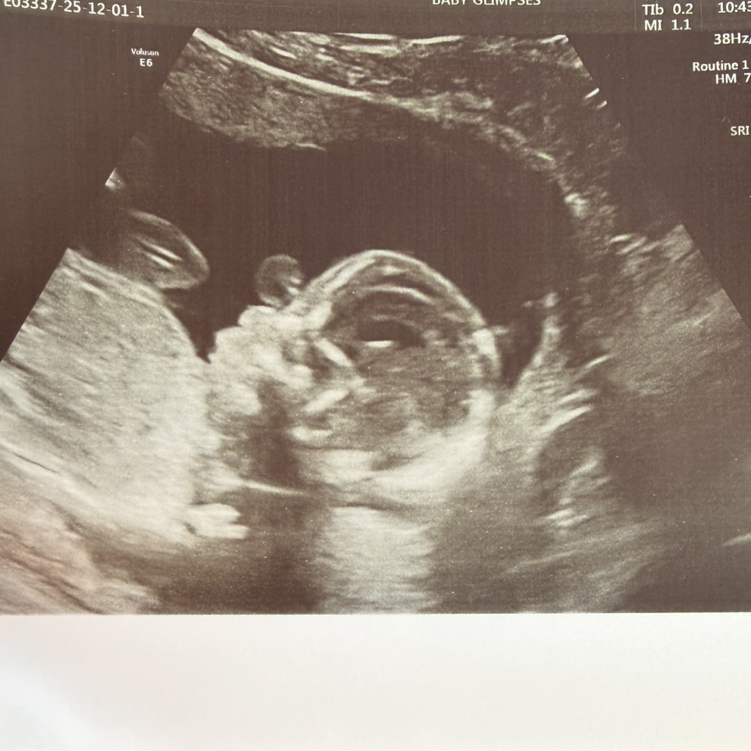 Photo shared by Jackelin for their Babylist baby registry.