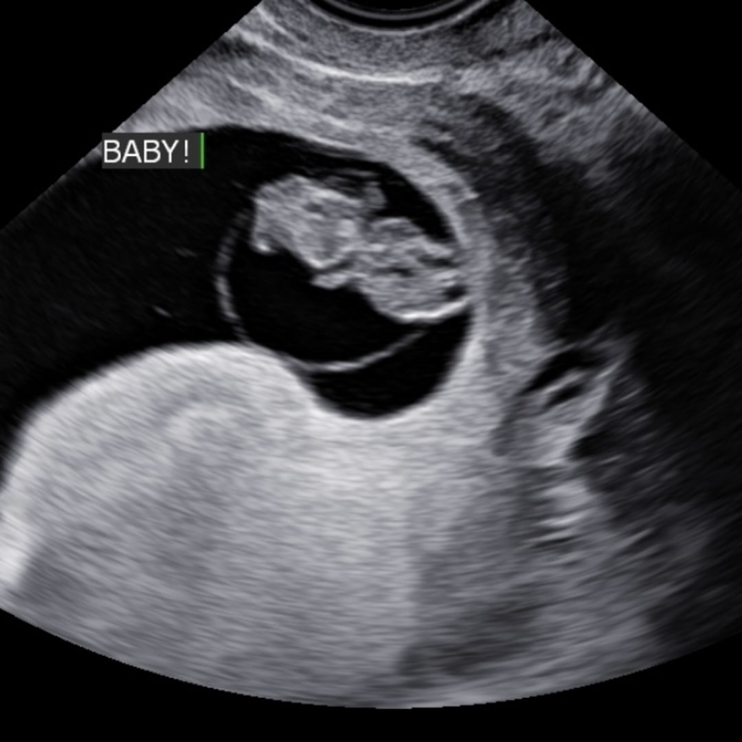 Photo shared by Madison for their Babylist baby registry.