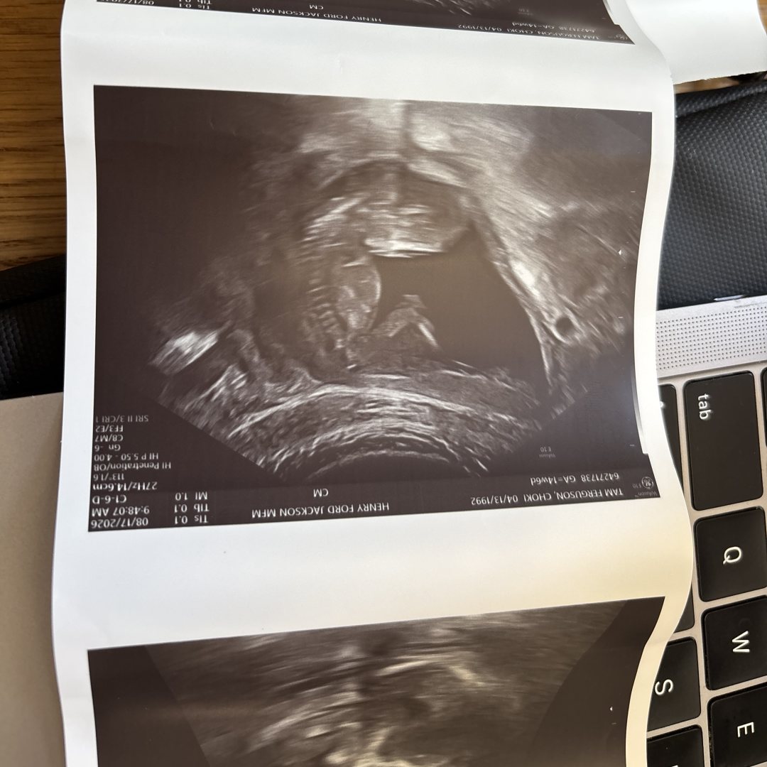 Photo shared by Choki for their Babylist baby registry.