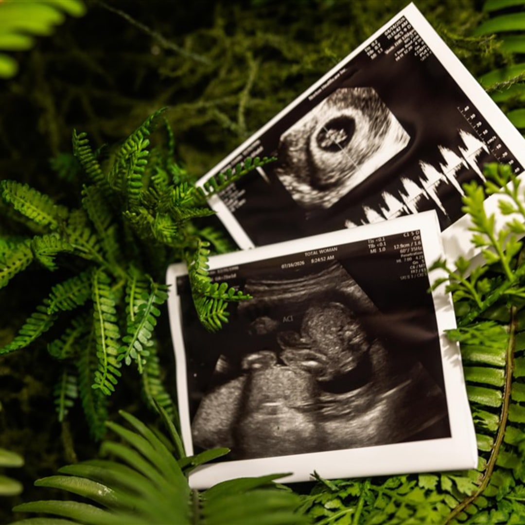 Photo shared by Cristin for their Babylist baby registry.