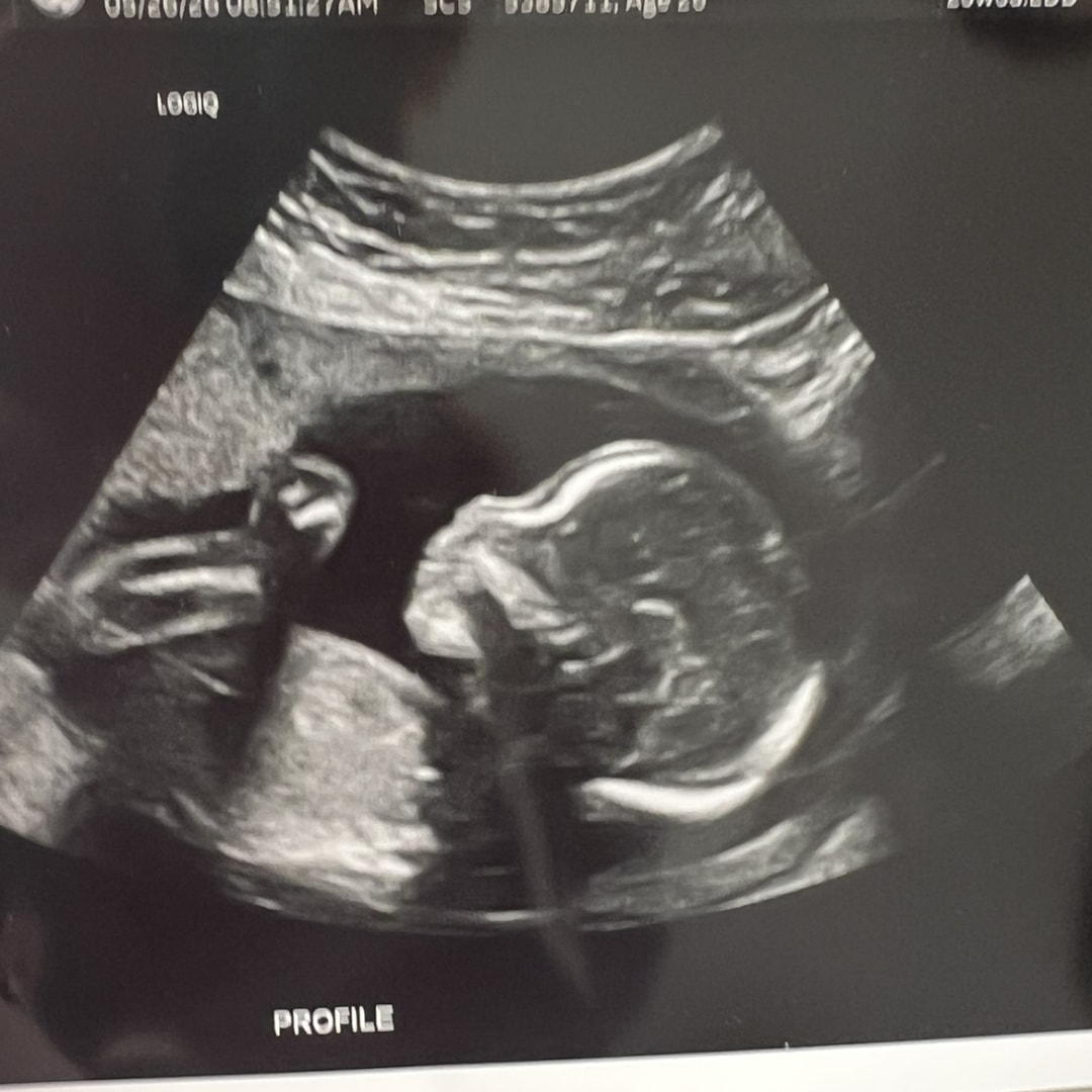 Photo shared by Grace for their Babylist baby registry.