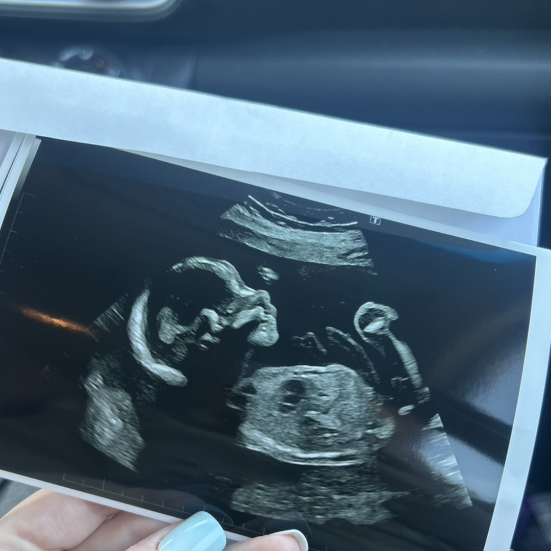 Photo shared by Jaime-Lee for their Babylist baby registry.