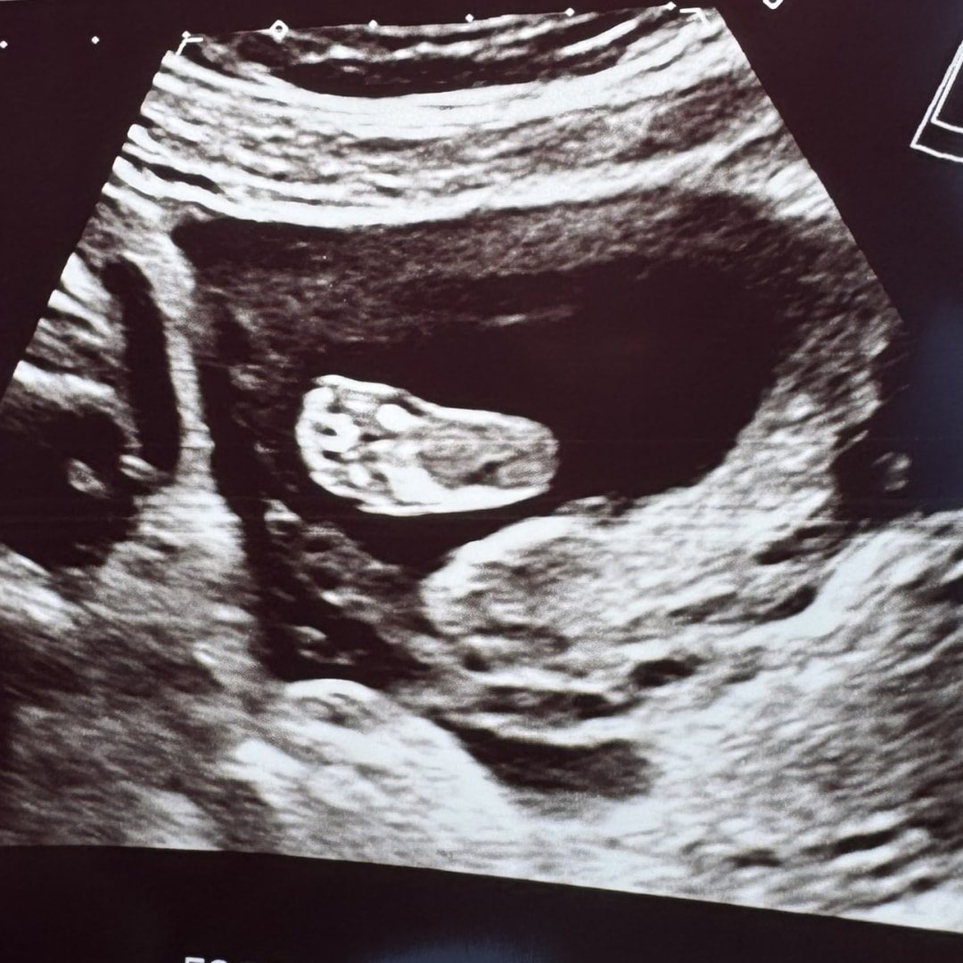 Photo shared by Hannah for their Babylist baby registry.
