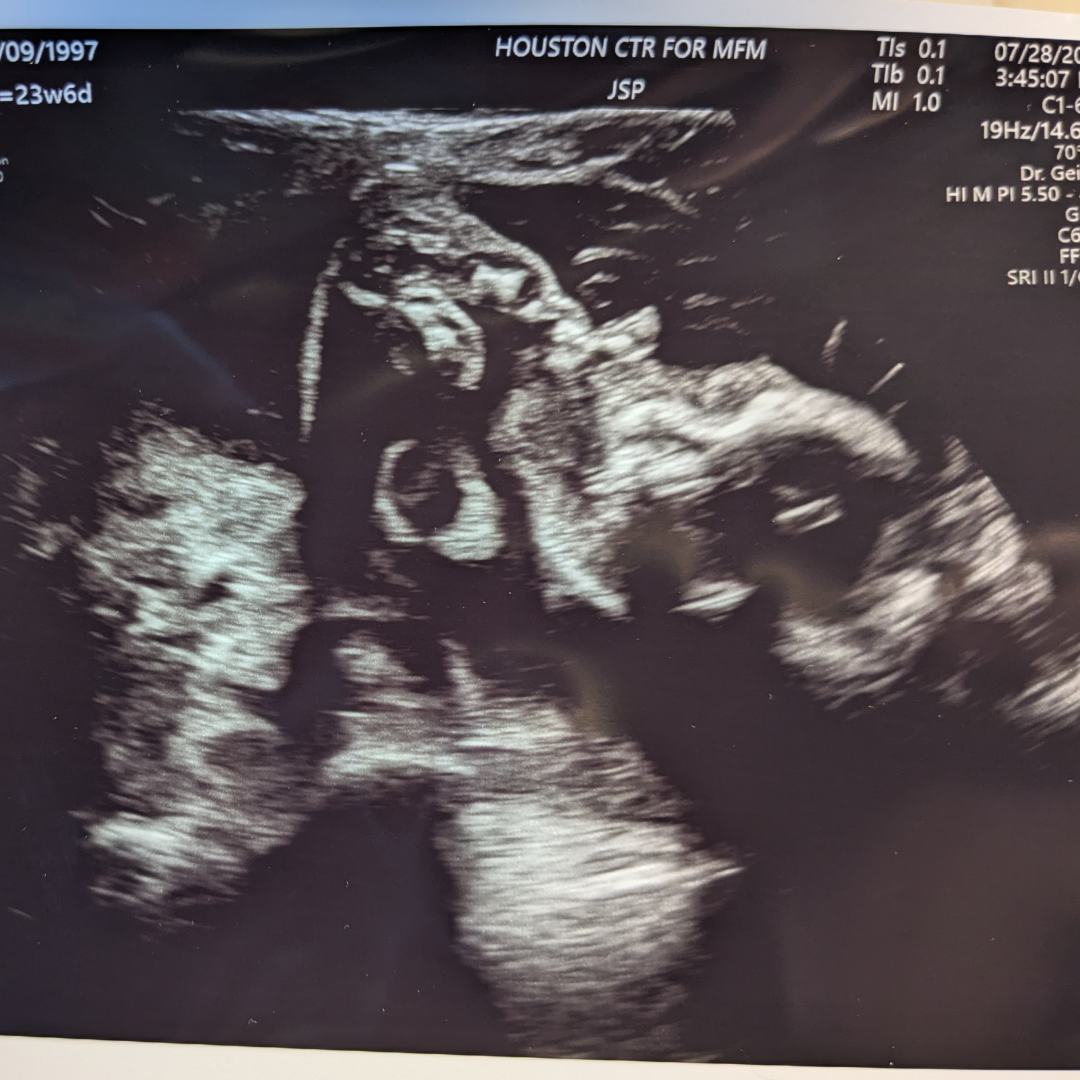 Photo shared by Erin for their Babylist baby registry.