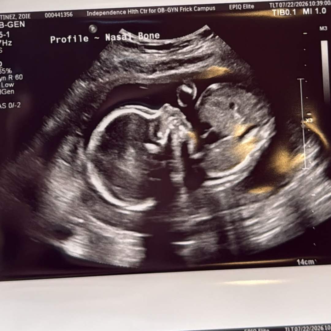 Photo shared by Zoie for their Babylist baby registry.