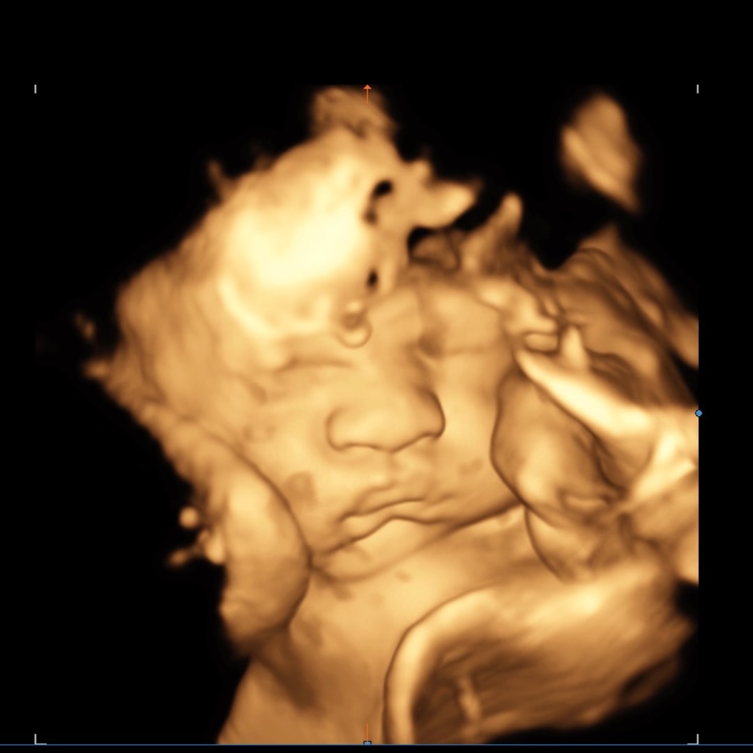 Photo shared by Brianna for their Babylist baby registry.