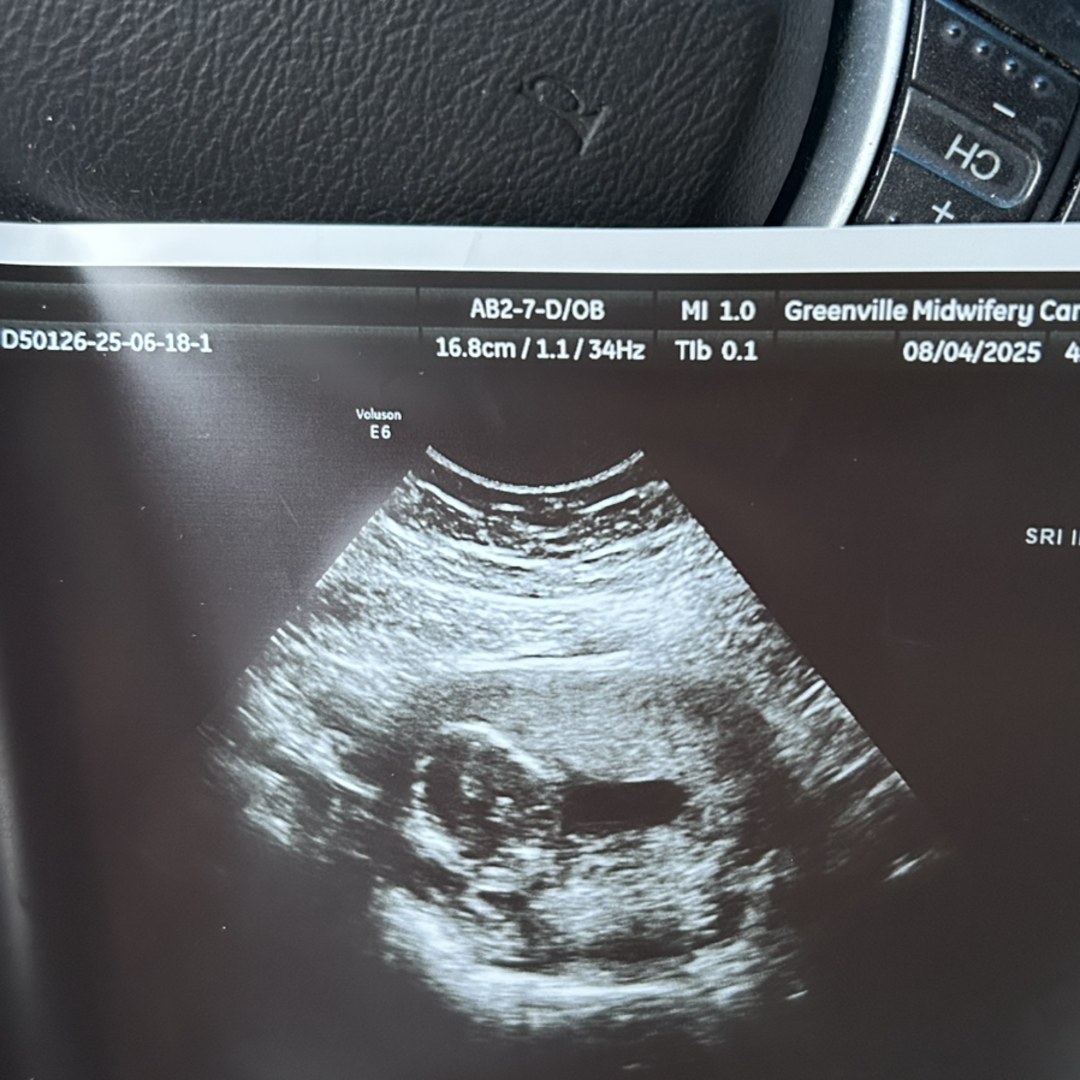 Photo shared by Brooklyn for their Babylist baby registry.