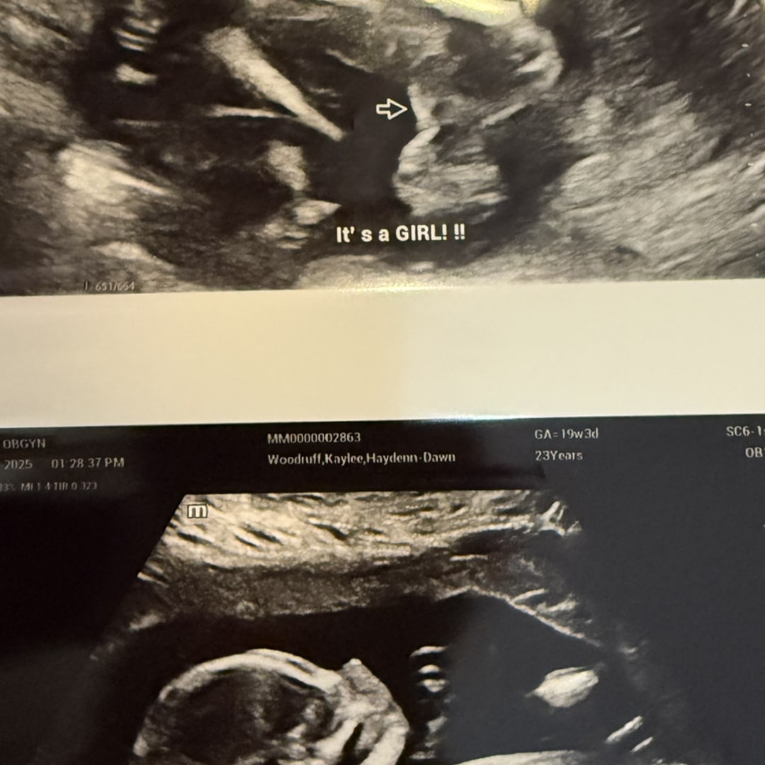 Photo shared by Kaylee for their Babylist baby registry.