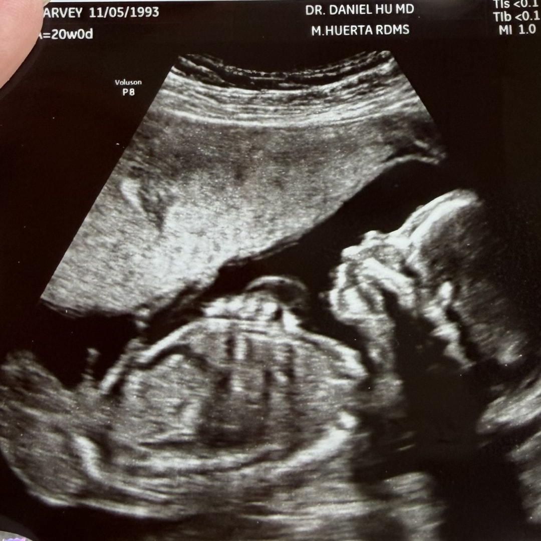 Photo shared by Harvey for their Babylist baby registry.