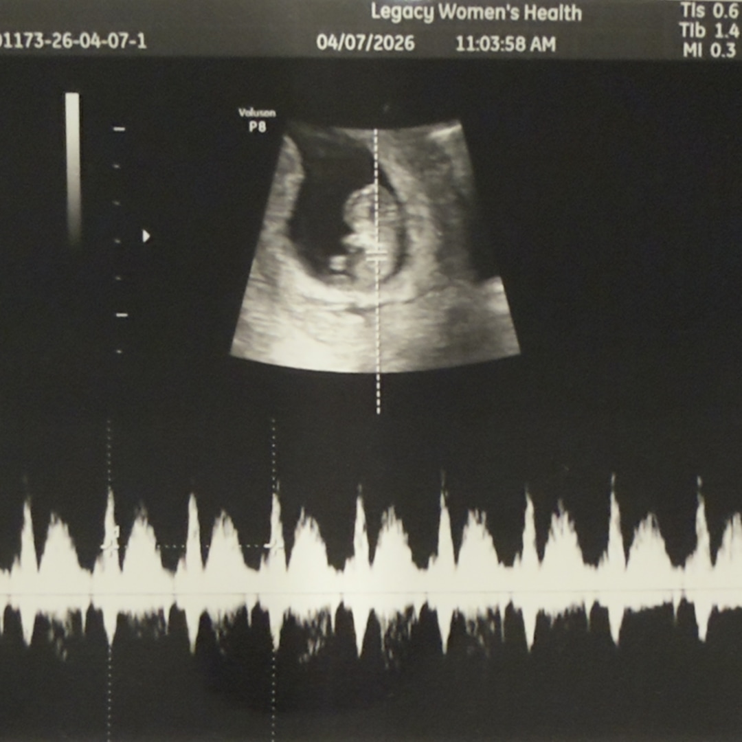 Photo shared by Evelyn for their Babylist baby registry.