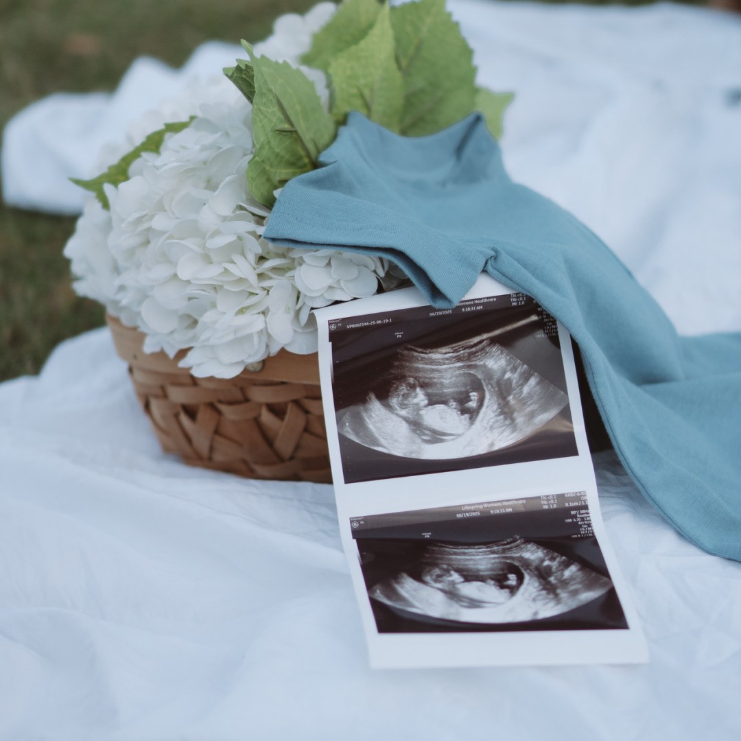 Photo shared by Logan for their Babylist baby registry.