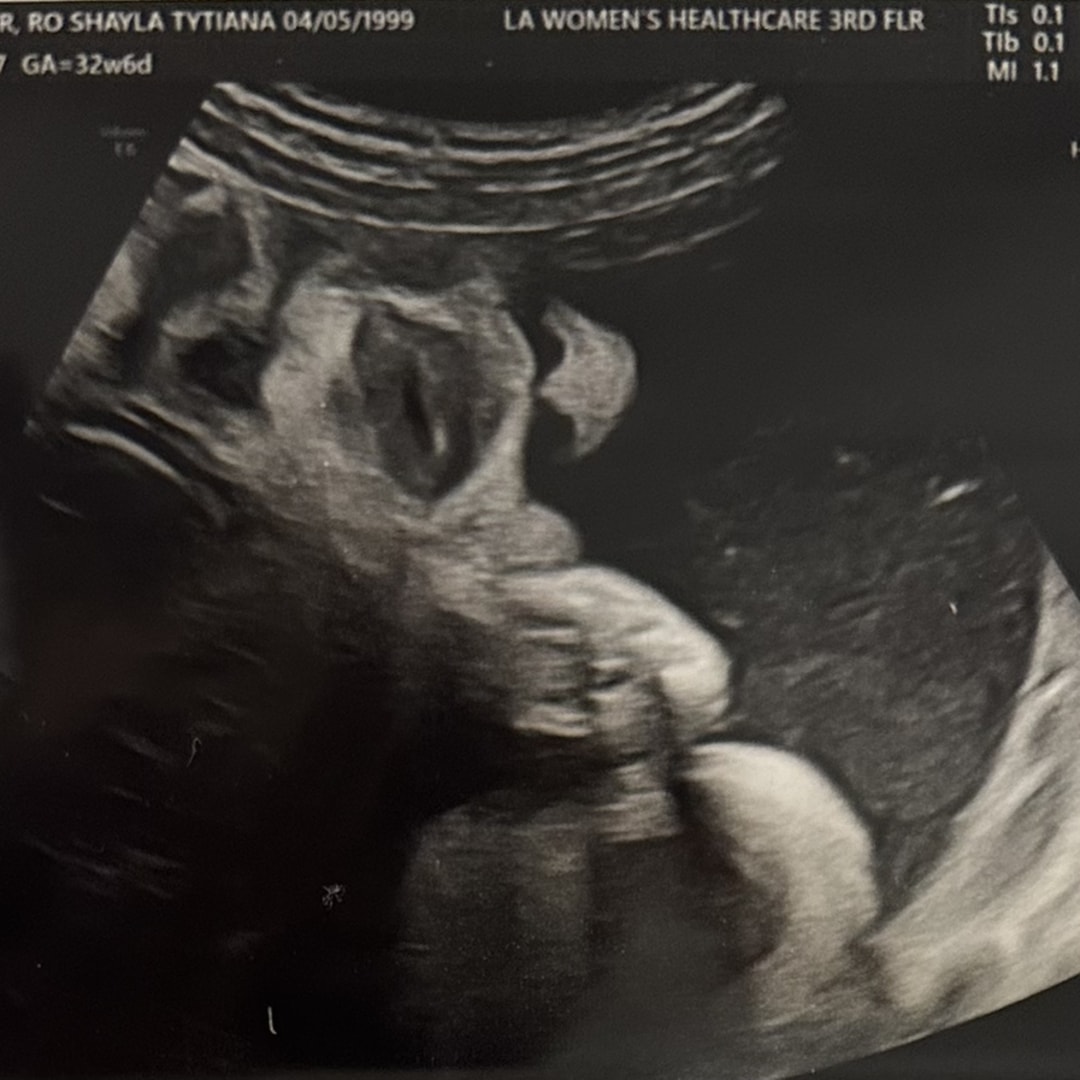 Photo shared by Ro'Shayla for their Babylist baby registry.