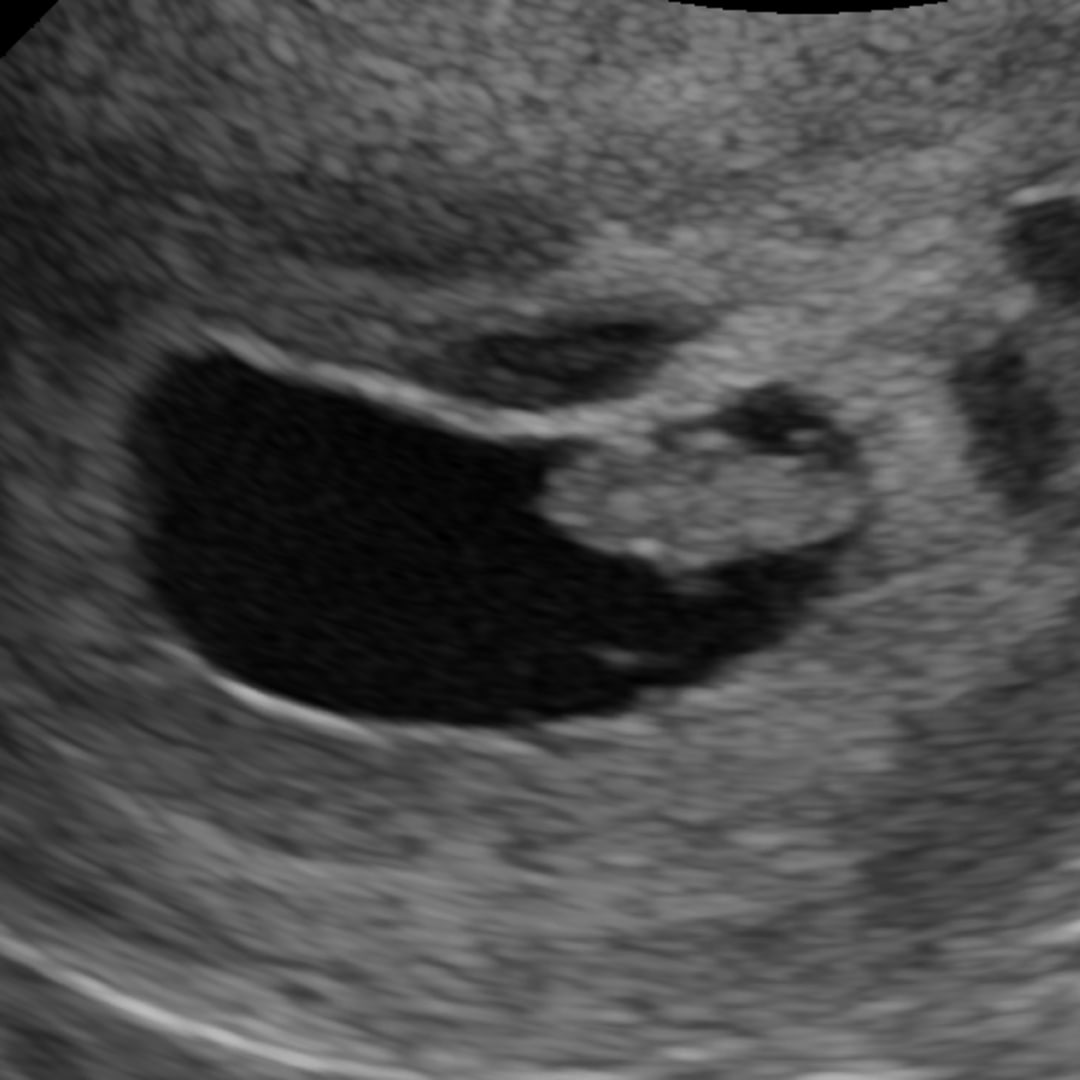 Photo shared by Jessica for their Babylist baby registry.