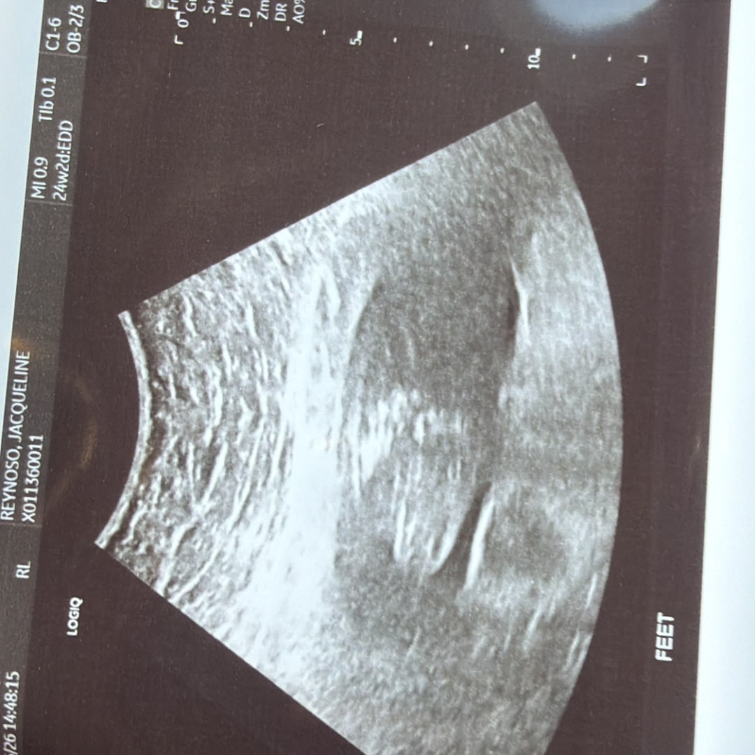 Photo shared by Jacqueline for their Babylist baby registry.