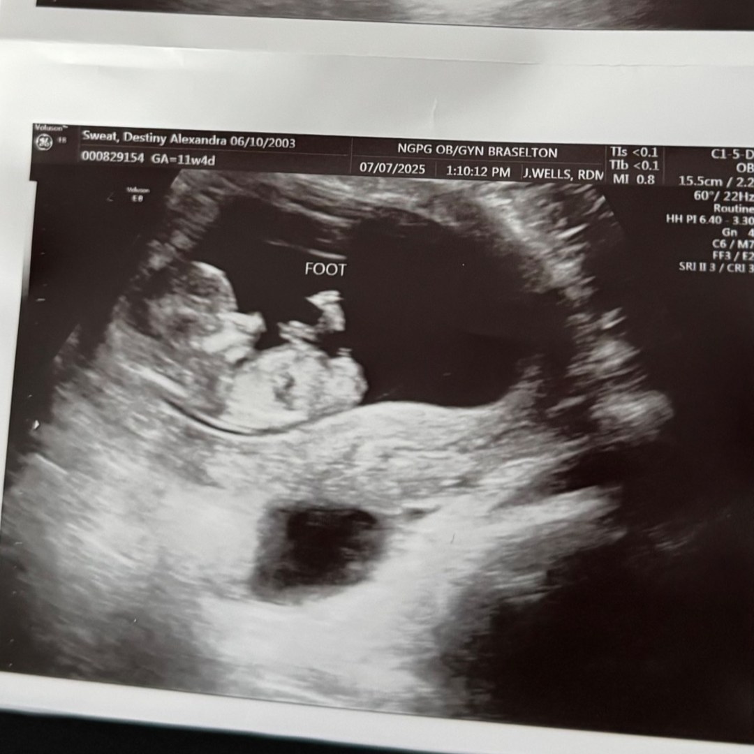 Photo shared by Destiny for their Babylist baby registry.