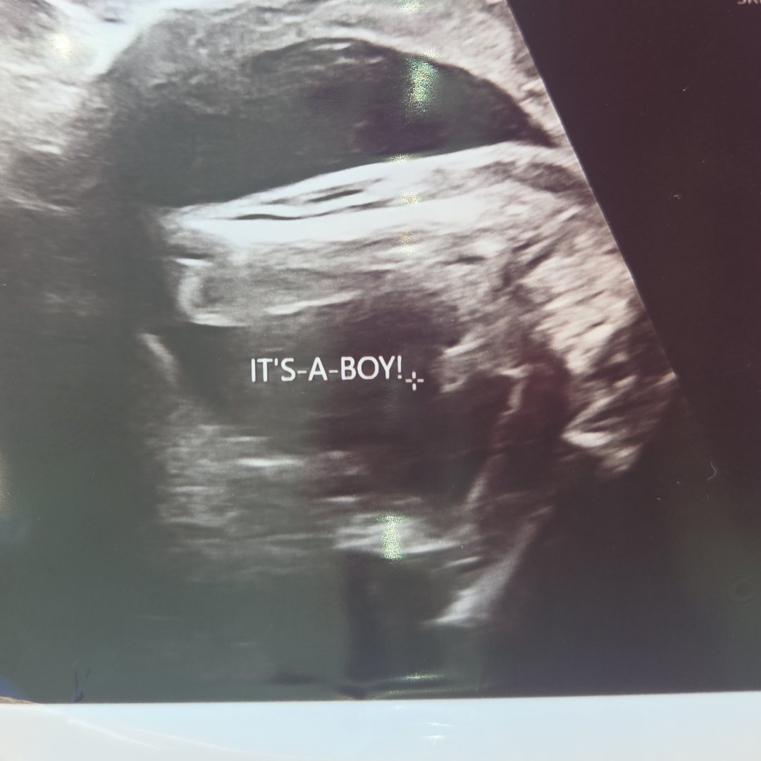 Photo shared by Melissa for their Babylist baby registry.