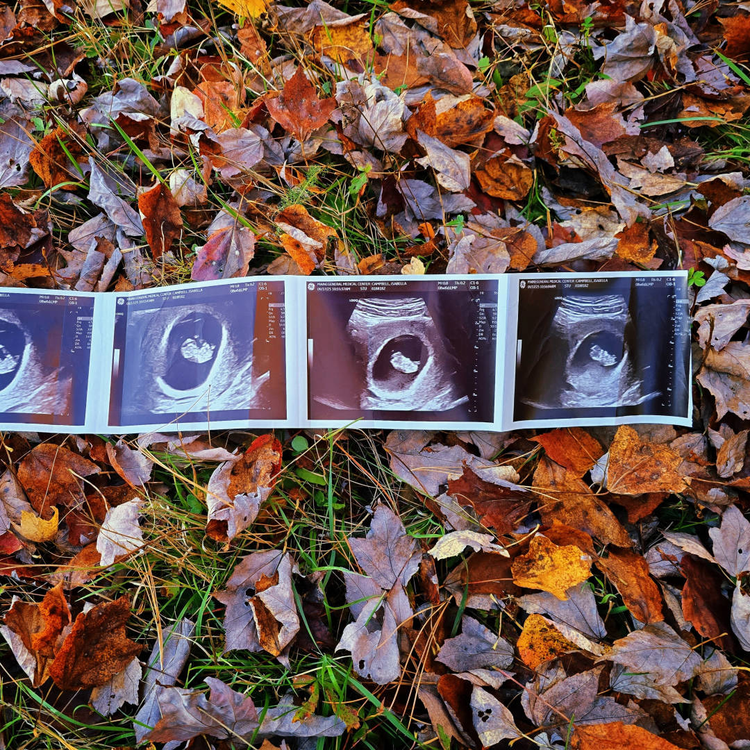 Photo shared by Isabella for their Babylist baby registry.