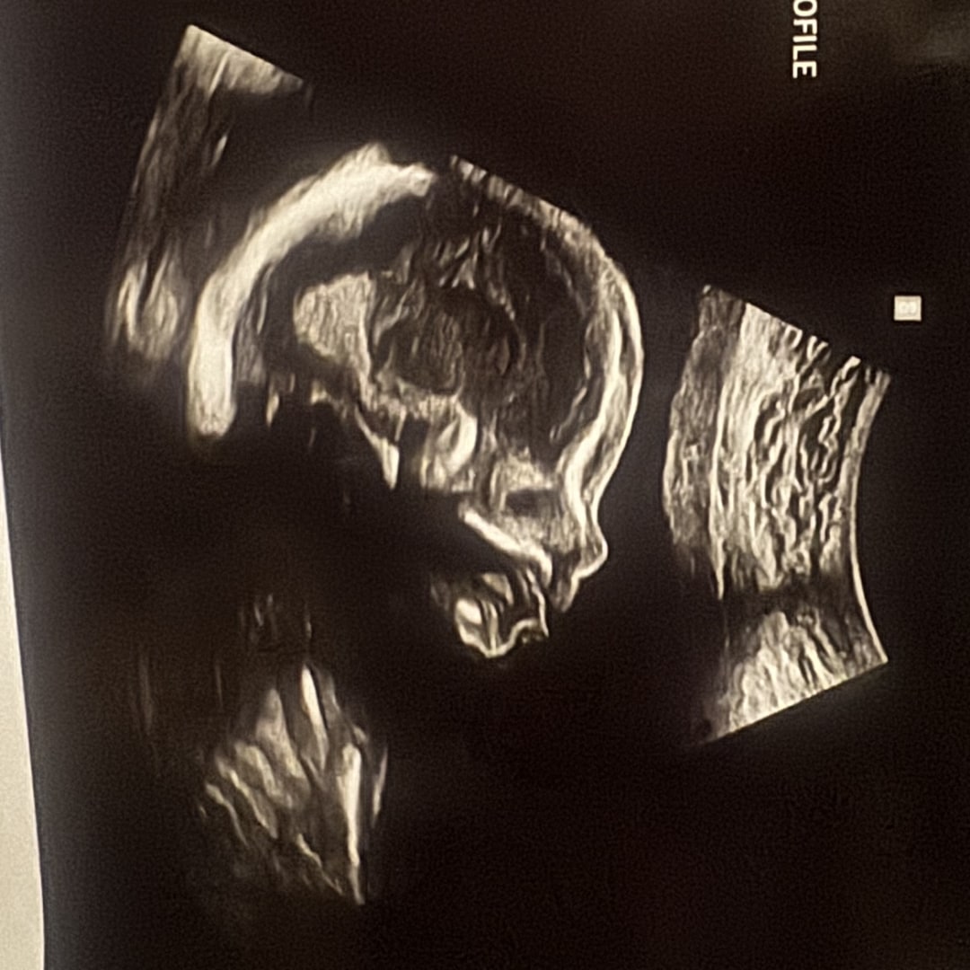 Photo shared by Mahailey for their Babylist baby registry.