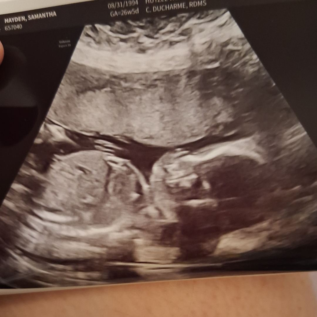 Photo shared by Samantha for their Babylist baby registry.