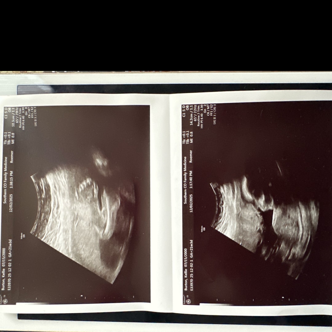 Photo shared by Kellie for their Babylist baby registry.