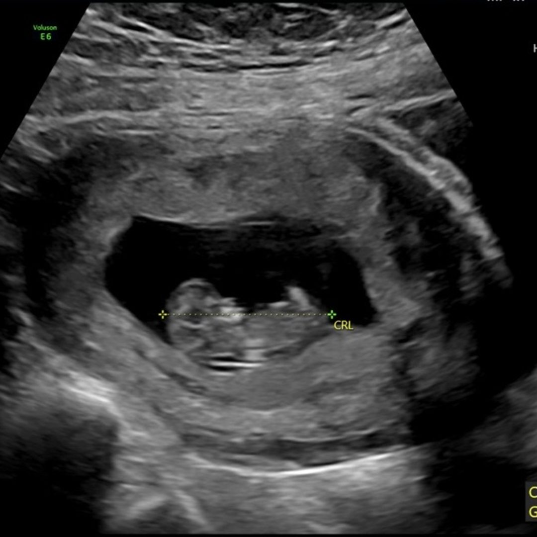 Photo shared by Ashlyn for their Babylist baby registry.