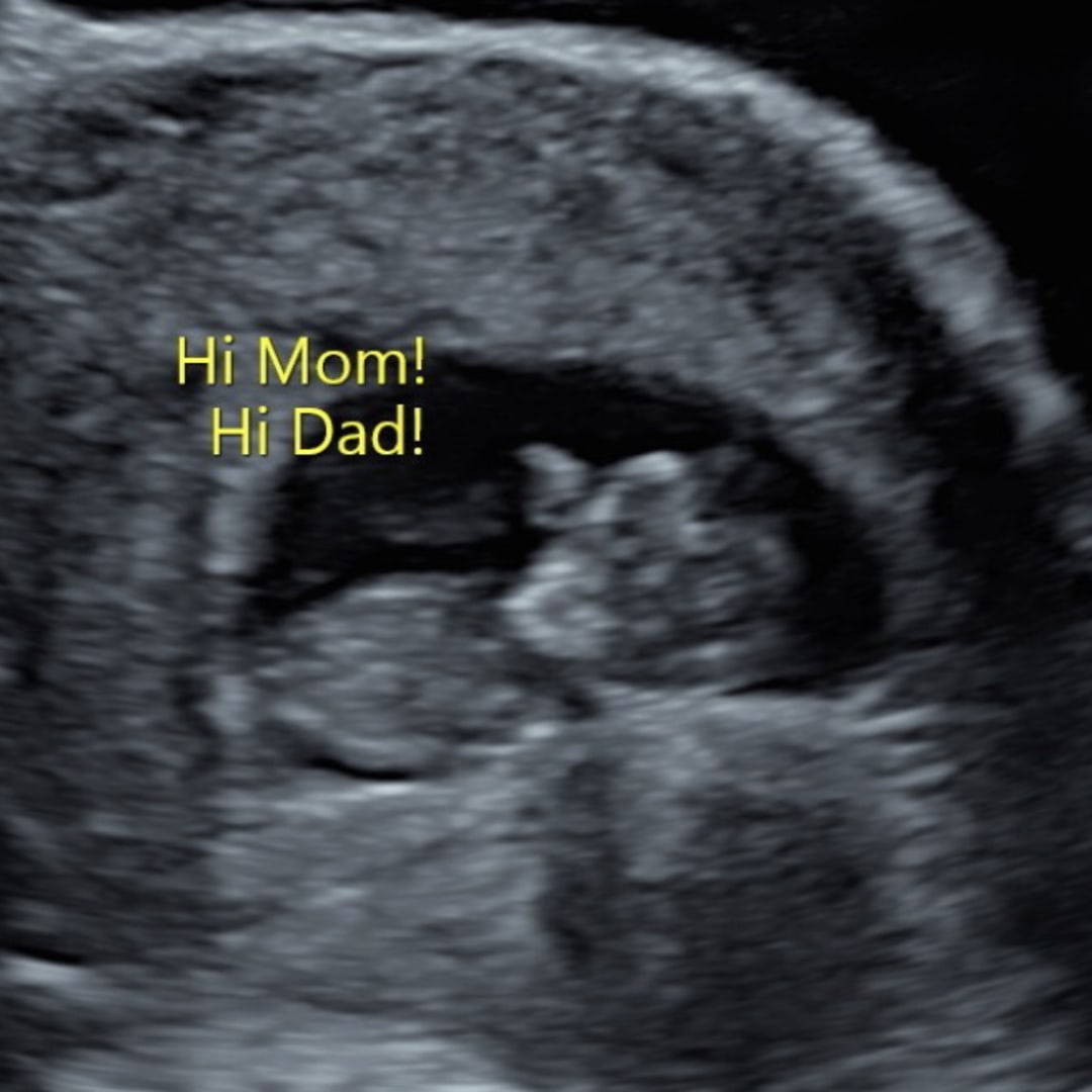Photo shared by Colleen for their Babylist baby registry.