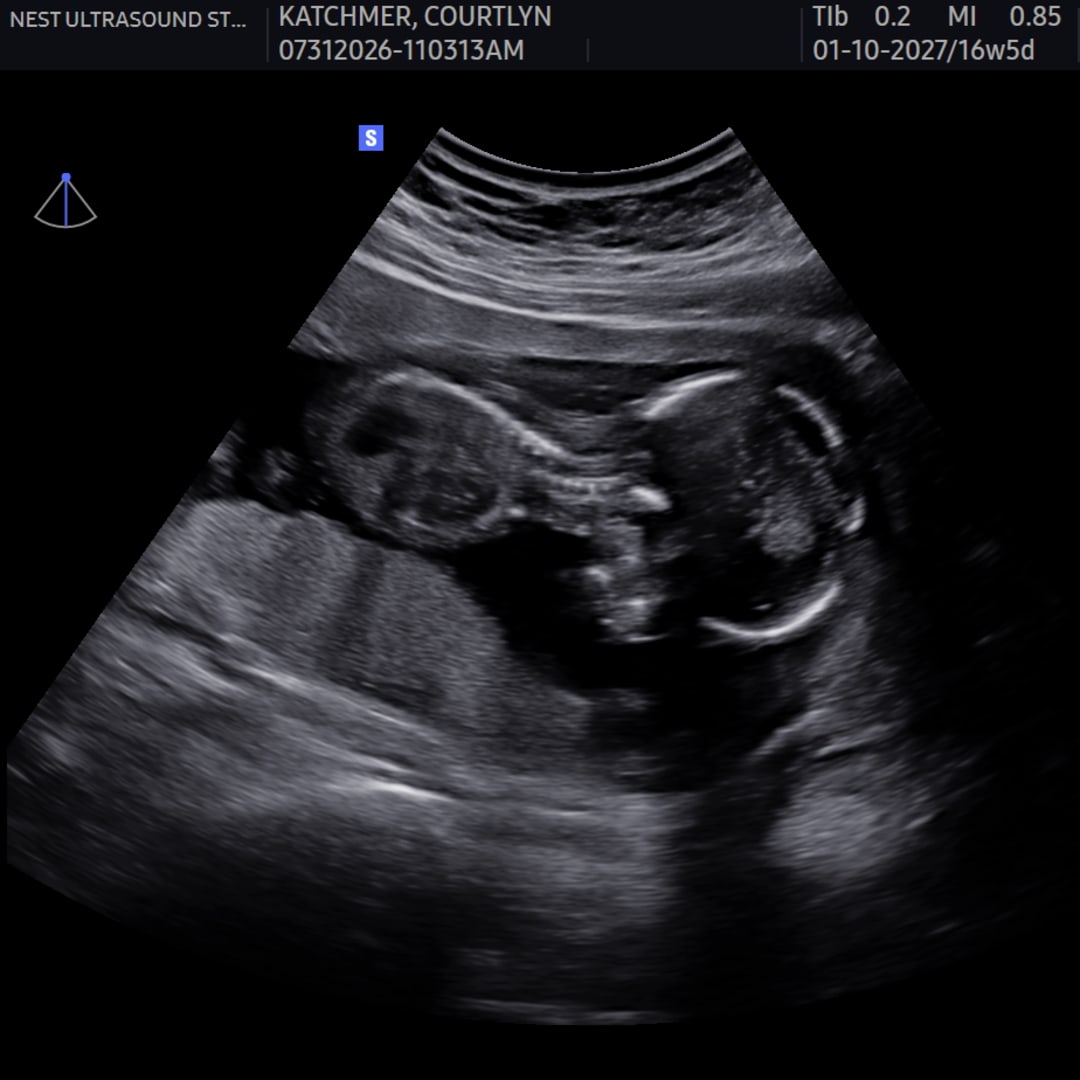 Photo shared by Courtlyn for their Babylist baby registry.