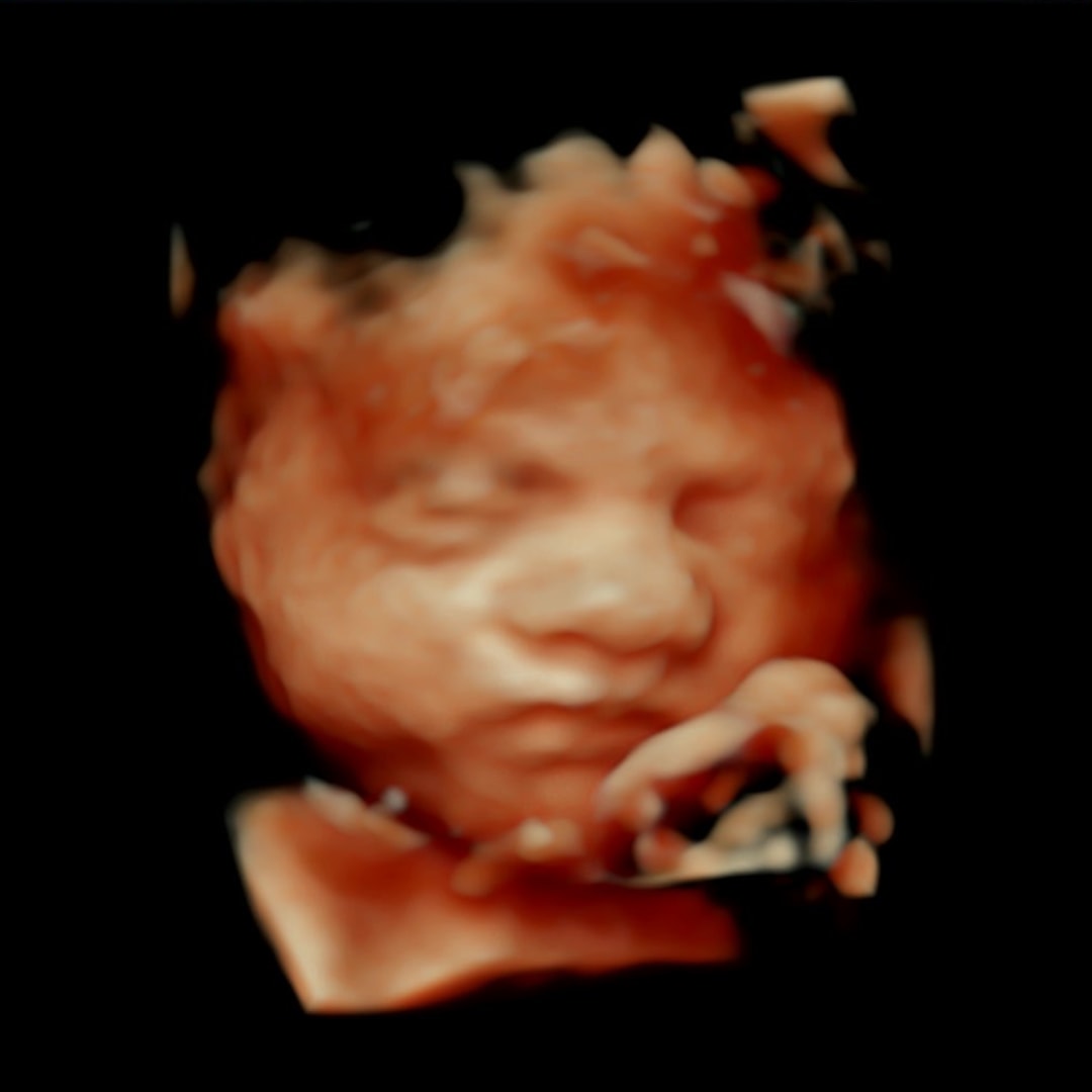 Photo shared by Kaylee for their Babylist baby registry.