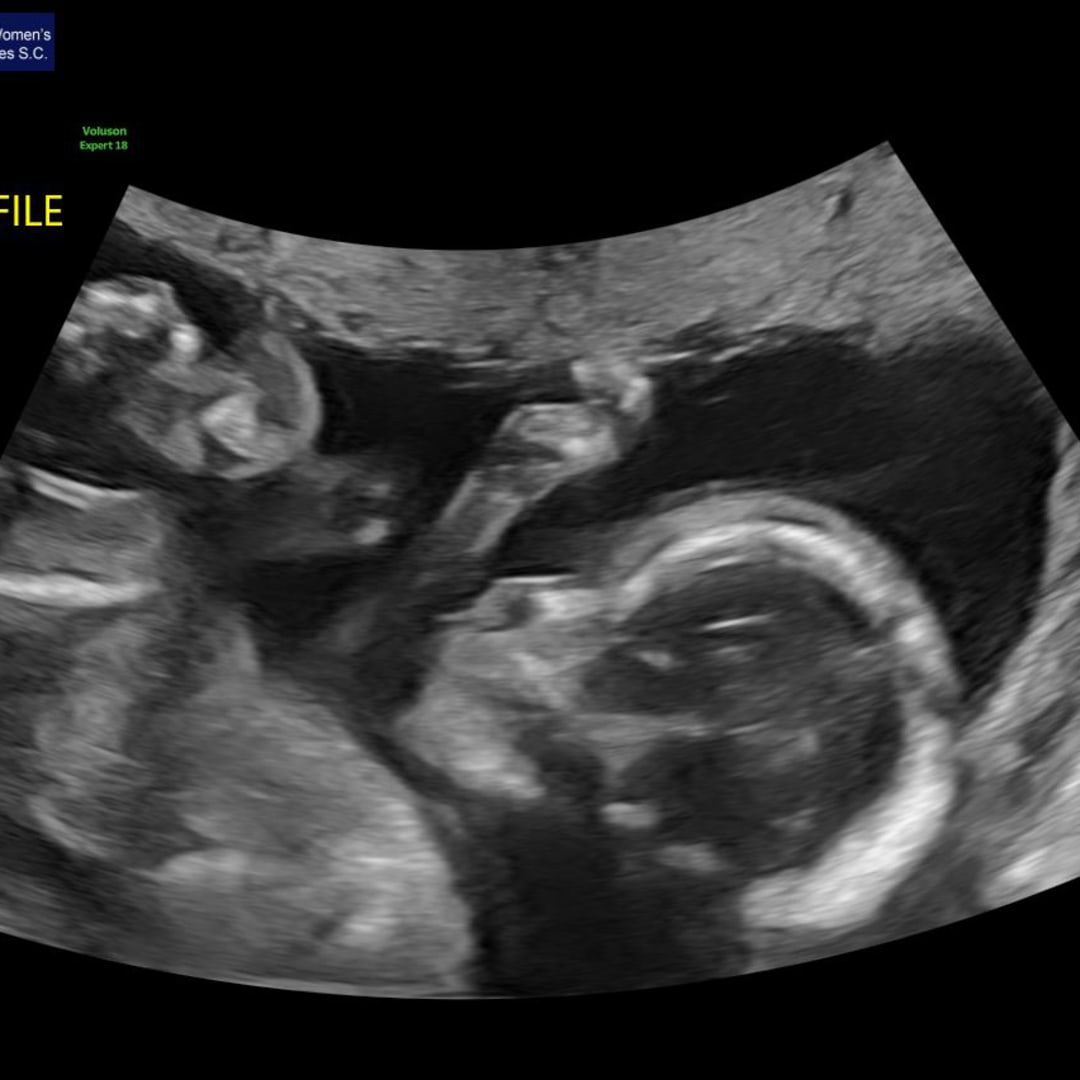 Photo shared by Jennifer for their Babylist baby registry.