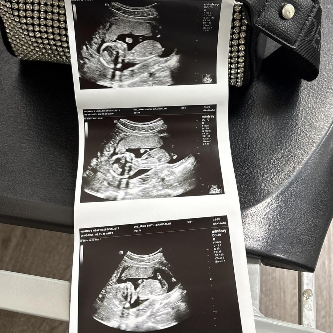 Photo shared by Brandalyn for their Babylist baby registry.