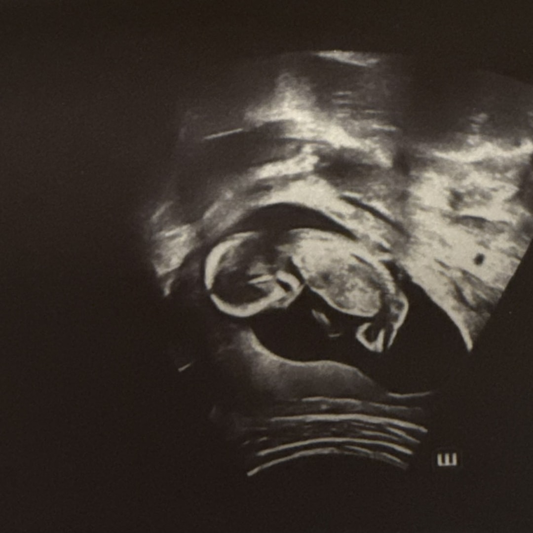 Photo shared by Courtney for their Babylist baby registry.